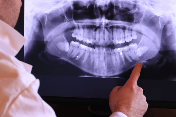 Best Emergency Denture Repair in Rock Hall, MD