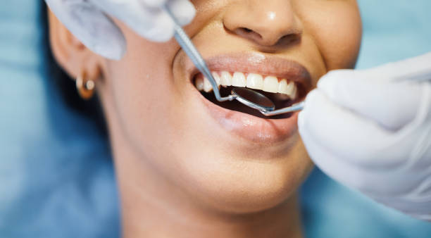 Best Emergency Dental Care for Broken or Chipped Teeth in Rock Hall, MD