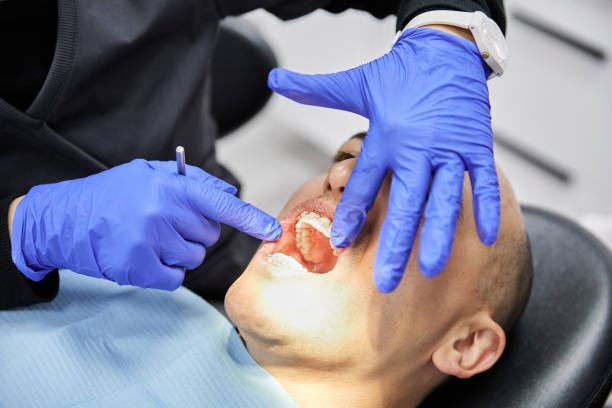 Best Emergency Dental Care for Broken or Chipped Teeth in Rock Hall, MD